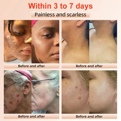 🔥Orange Enzyme Exfoliating Gel — The Gentle Miracle Your Skin Has Been Crying Out For