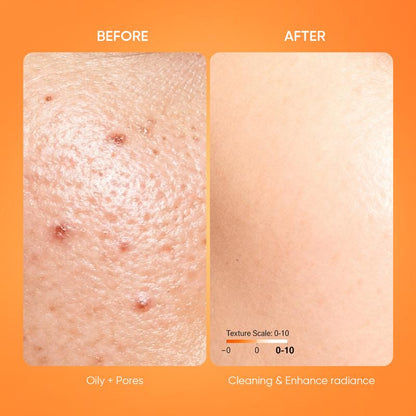 🔥Orange Enzyme Exfoliating Gel — The Gentle Miracle Your Skin Has Been Crying Out For